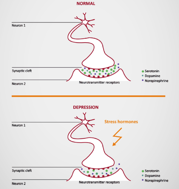 DEPRESSION PEMF Malaysia